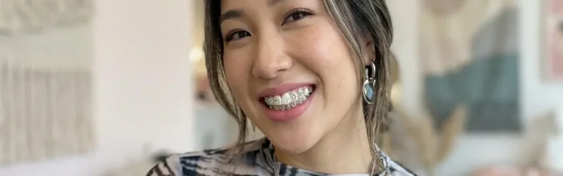 Ketahui Tooth Gem, Hiasan Gigi Centil ala Naykilla!
