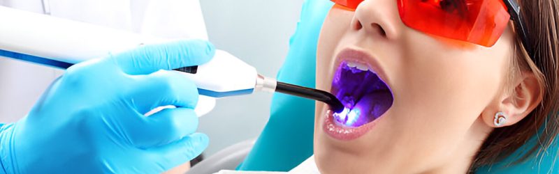 Laser Gigi_ Macam dan Manfaatnya