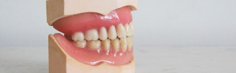 Plak Gigi: Penyebab dan Cara Menghilangkannya