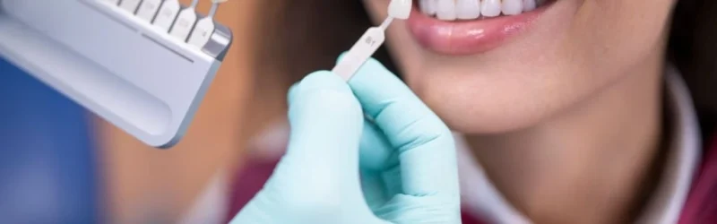 Veneer Gigi Renggang, Solusi Senyum Menjadi Rapat & Cantik!