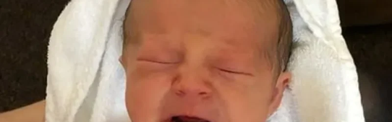 Bayi Baru Lahir Punya Gigi, Apakah Normal?